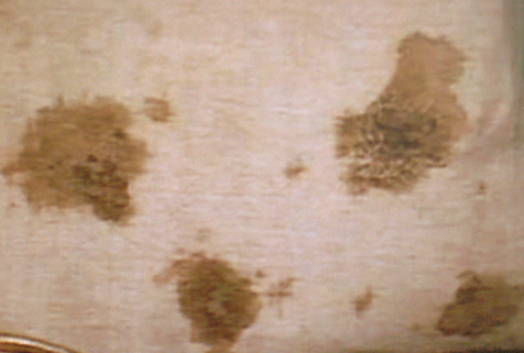 Detail of the Blood stains present on the corporal of the miracle