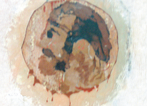 Enlarged reproduction of the face which appeared in the