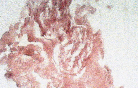 A vagus nerve