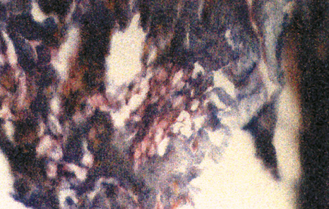 A small lobe of adipose tissue